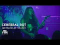 Download Lagu CEREBRAL ROT live at Saint Vitus Bar, Apr. 12th, 2023 (FULL SET)