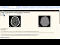 Interactive Image Compression using Wavelet Transform MRI Scans Demo