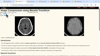 Interactive Image Compression using Wavelet Transform MRI Scans Demo