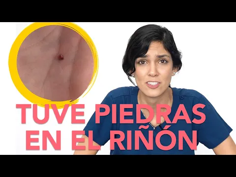 Download MP3 Mi experiencia con piedras en el riñón (CÁLCULOS RENALES) | Dra. Jackie - Salud en Corto