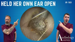 So Narrow the Patient Had to Hold Her Ear Open – EP1323