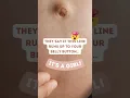 Download Lagu Linea Nigra Predicts Gender? 🤫😲 #shorts