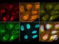 Introduction to the Cell Painting Assay - AskErinDearBeth Episode 23