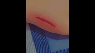 رسم جرح على اليد 