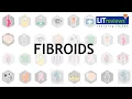 Fibroids
