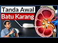Download Lagu Batu Karang Buah Pinggang | 5 Tanda Awal Wajib Tahu | Doctor Sani |
