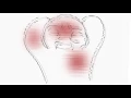 What Leads To Suicide