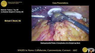 Download Gastropericardial fistula: A complication of an eroded lap band MP3