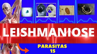 LEISHMANIOSE VISCERAL E LEISHMANIOSE TEGUMENTAR (LEISHMANIA SSP) - PARASITOLOGIA |INFECTOLOGIA