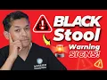 Black Tarry Stool Here s What It Means for Your Gut Health
