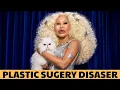 30 Celebrities Before After Plastic Surgery You Won t Believe the Difference Then Now 2026