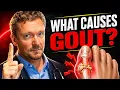 What Causes Gout Meat Doesn t - The Real Triggers Doctors Miss