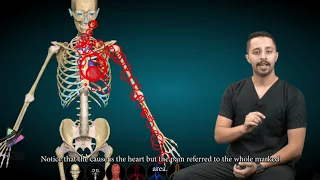ألم العضلات الرجيع  العقد العضلية                                           دندنها