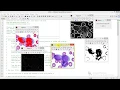 Blood Leukemia Cancer Detection Using Matlab Full Project Code