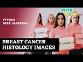 Python Machine Learning Project Classification of Breast Cancer Histology Images ClickMyProject