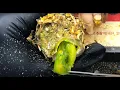 Download Lagu CUT Ingrown Toenails, Toenails with Maggots, Fungal Toenails // TREATMENT OF Ingrown Toenails N104