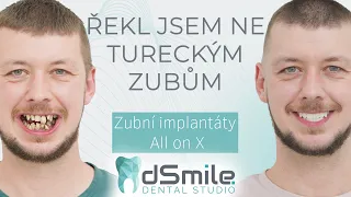 Implantace v Praze nebo v Turecku? Proč jsem si vybral léčbu v Česku