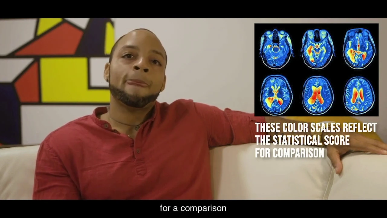 Introduction to Brain and Consciousness 1.6 - fMRI