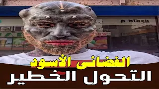 من شاب وسيم الي كائن فضائي هذا ما فعله الشاب الفرنسي ليحقق أمنيتة فى التحول المخيف 