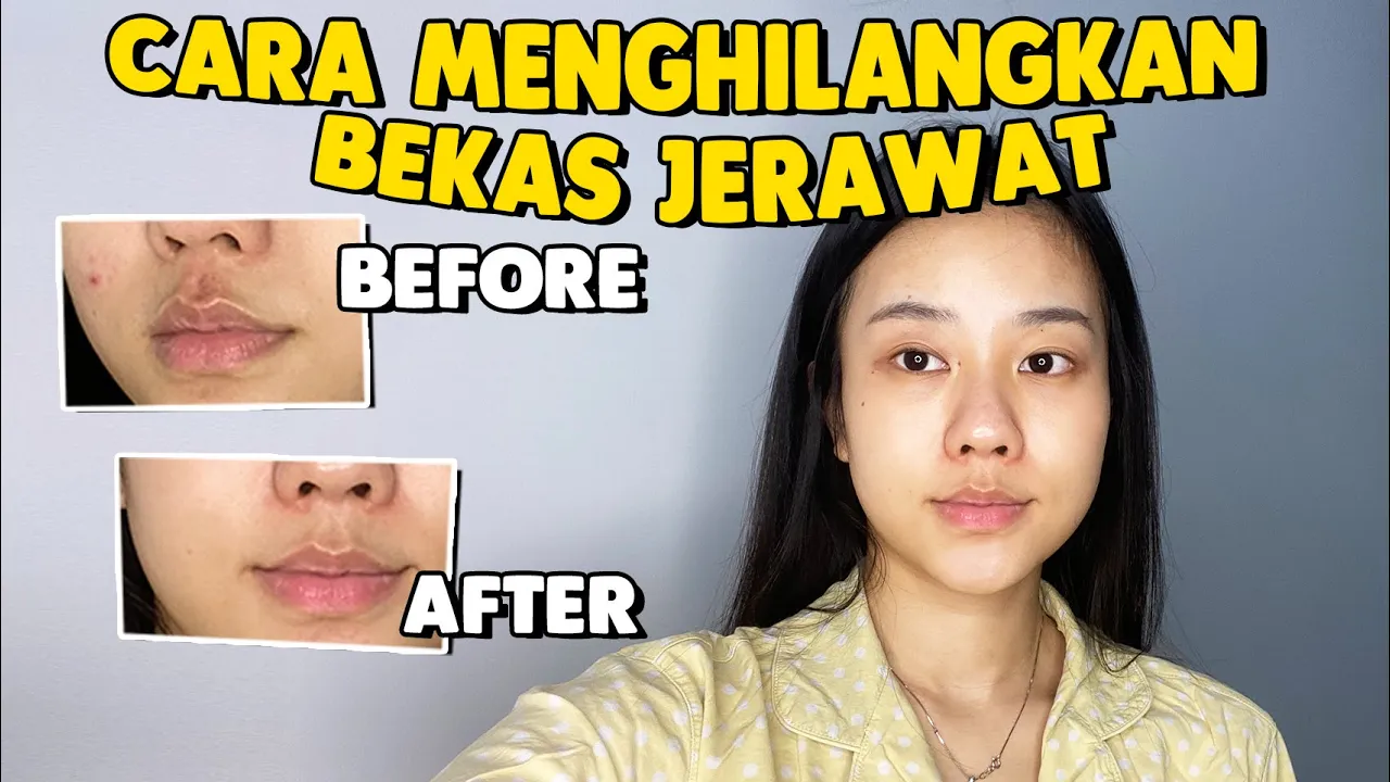 
          
          
          
            
            CARA MENGHILANGKAN BEKAS JERAWAT - SKIN CARE ROUTINE
          
        . 