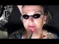 Rev Lite Laser Skin Toning and Rejuvenation by Dr Carolyn Choy Ultimate Aesthetics