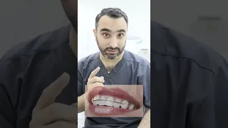 أفضل نوع مثبت   دندنها