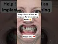 Missing tooth Nesbit Affordable option to replace that missing tooth