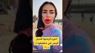 اميره قرصها قنديل البحر في شفايفها عائلة ميرو اميره وعبدالرحمن اكسبلور Explore ايلين 