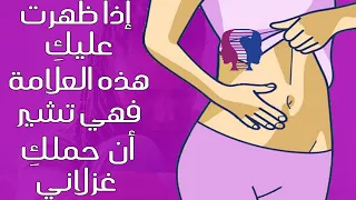 إذا ظهرت عليك هذه العلامة فهي تشير إلى أنك حامل حمل غزلاني 