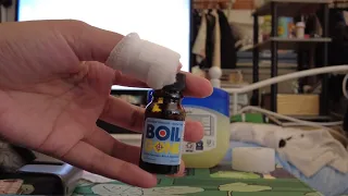boil gone Product I found while searching the internet Really Helps