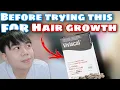 Before taking VIVISCAL for HAIR GROWTH HAIR LOSS consider these