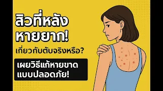 สิวที่หลังเกิดจากสาเหตุอะไรบ้าง