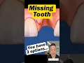 3 Options for Replacing a Missing Tooth Dentist Explains