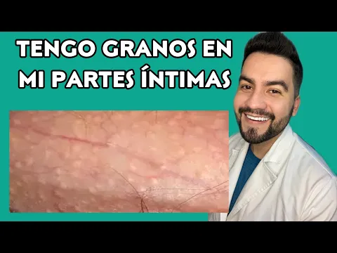 Download MP3 TENGO GRANOS BLANCOS EN EL PENE / GRANOS DE FORDYCE / MANCHAS DE FORDYCE | DR. DAVID CAMPOS