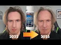 Does Minoxidil cause skin aging