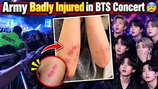 BTS Security Failed 😡 Army Badly Injured in BTS Concert Buenos Aires 😱 Serious Injury 🤕#bts #btsarmy