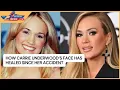 How Carrie Underwood s Face Has Healed Since Her Accident