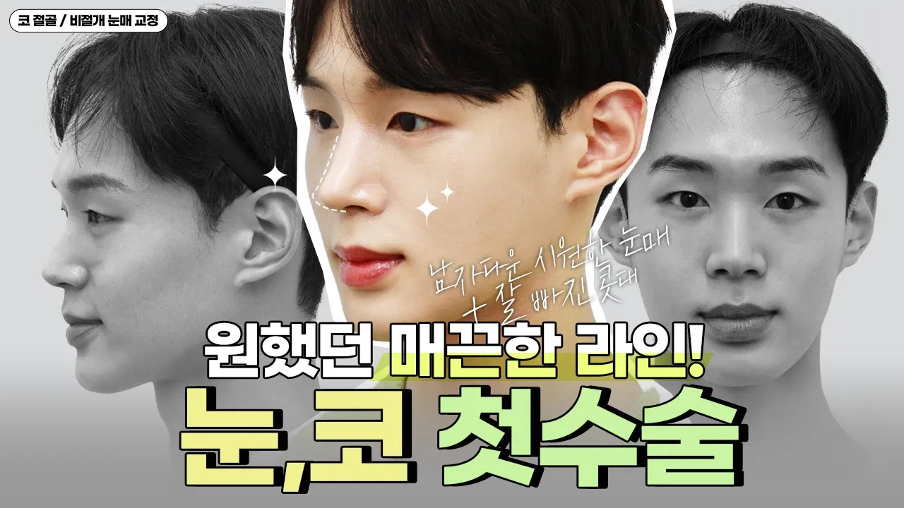 [VLOG] 눈과 코 첫 수술~ 👃 👁️ 매끈한 라인 이뤄내고 말 거예요!!