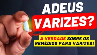 Remédio para VARIZES e DORES nas pernas - Existe remédio para eliminar as varizes ?