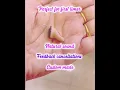 Download Lagu Resound Key3 CIC hearing aid#hearingaids #besthearingaids #trending #shortvideo #viral #viralvideo
