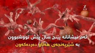 ئەم نیشانانە پێنج ساڵ پێش تووشبوون بە شێرپەنجەی هەناو دەردەکەون 