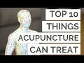 The Top 10 Conditions Acupuncture Can Help