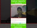 driver drowsiness detection using Python OpenCV