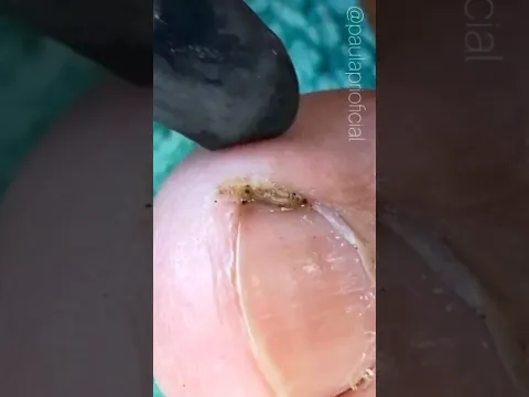O que é isso nesse dedo? Só labafero #viral #fly #vídeosatisfatorio
