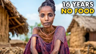 هذه المرآه لم تأكل منذ ١٦ عام ا أكد الأطباء 