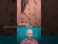 Download Lagu Your daily dose of satisfying hair plucking😁 (credit: @beardplucking on TT)#ingrownhair #satisfying