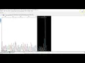 Step on obtained DNA sequences using Bioedit software and NBCI