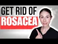 How To Get Rid Of Rosacea Dermatologist Tips