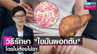 การรักษาโรคไขมันพอกตับควรทำอย่างไร ไม่ใช้ยา แล้วมีแนวทางสำคัญอะไรบ้าง