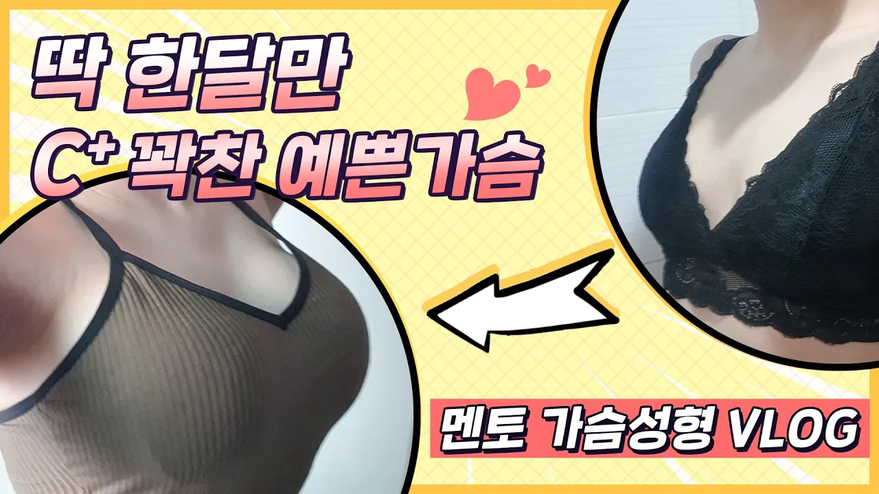 [KOR/ENG Sub]드디어 가슴성형수술 했습니다,풀C컵 됐어요! Victoria's Breast Augmentation Surgery Journey in Korea